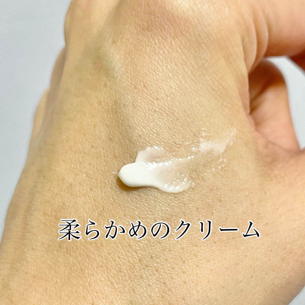 ペアアクネクリームW(医薬品)/ペア/その他を使ったクチコミ(2枚目)