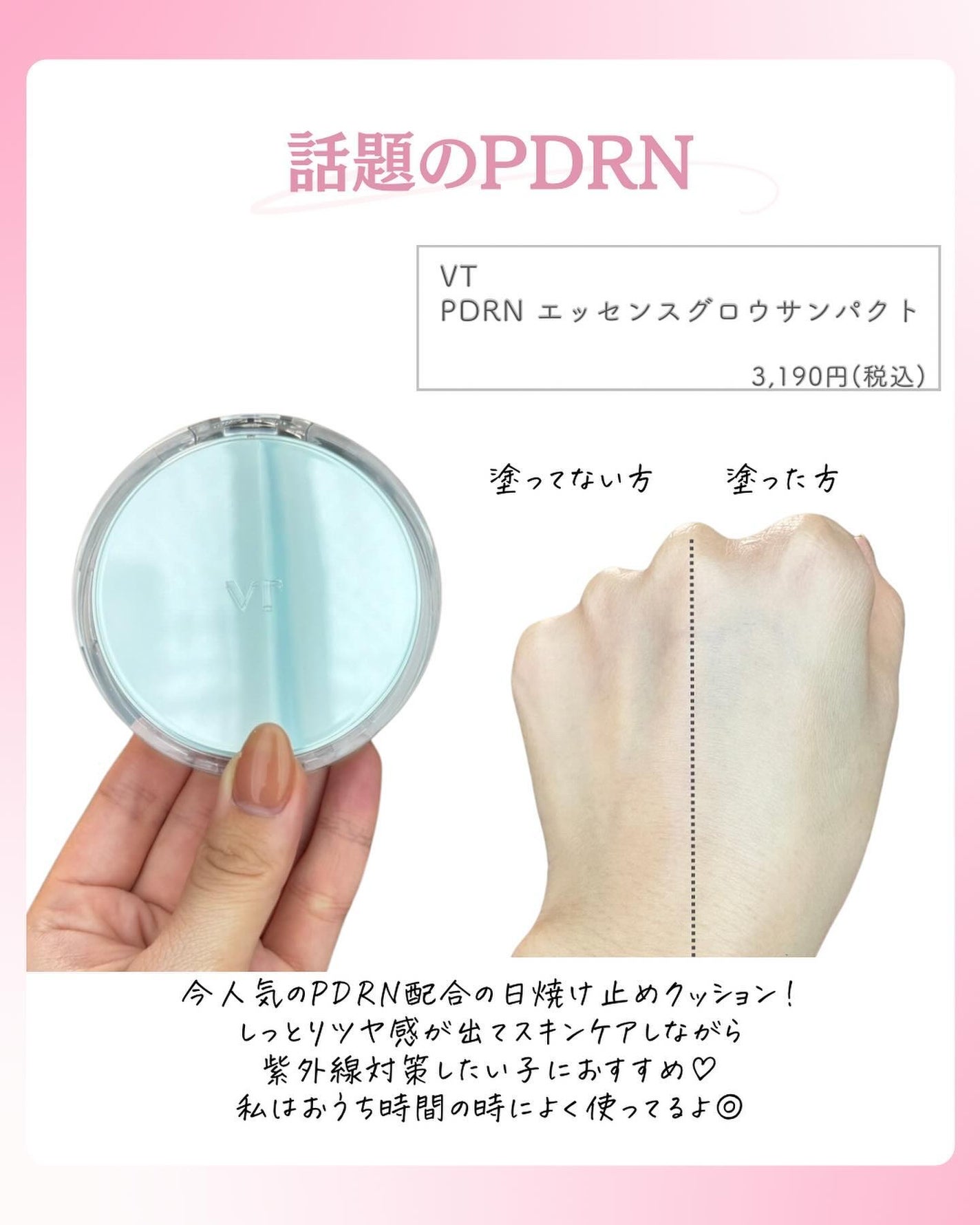 ðºð¬ðµðšðçŸå®¹ã¡ãã£ã¢ on LIPS ã@sena_biyouâïžâïžâïžä»ã®æçš¿ã¯ãã¡ãâšâšãã€ãã..ãïŒ9æç®ïŒ