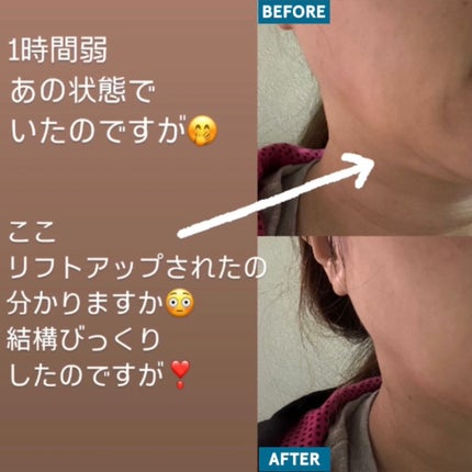 9番 NMNバイオリフトラッピングマスク/numbuzin/シートマスク・パックを使ったクチコミ(8枚目)