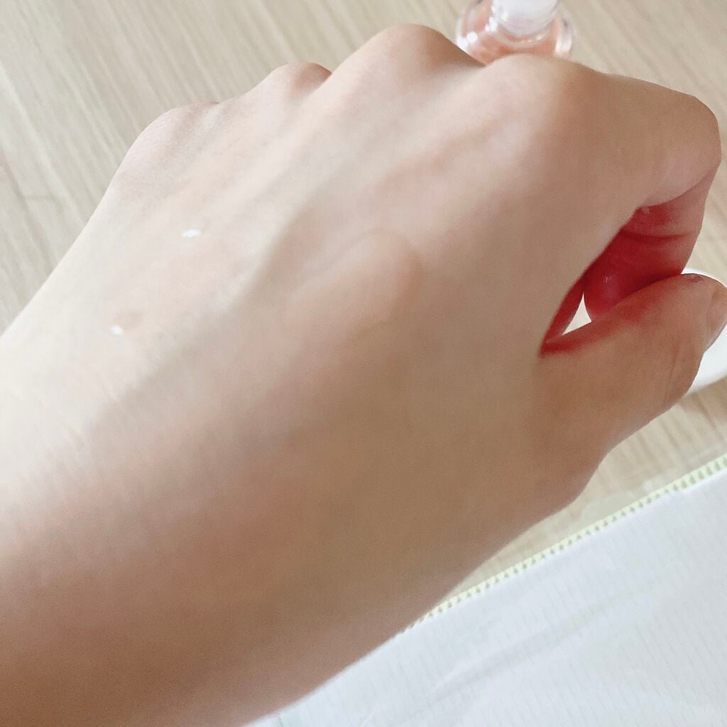 バイオイル/バイオイル/フェイスオイルを使ったクチコミ(2枚目)