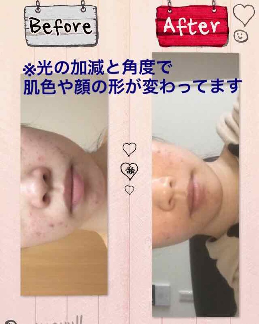 アルビオン エクラフチュール/ALBION/美容液を使ったクチコミ（3枚目）