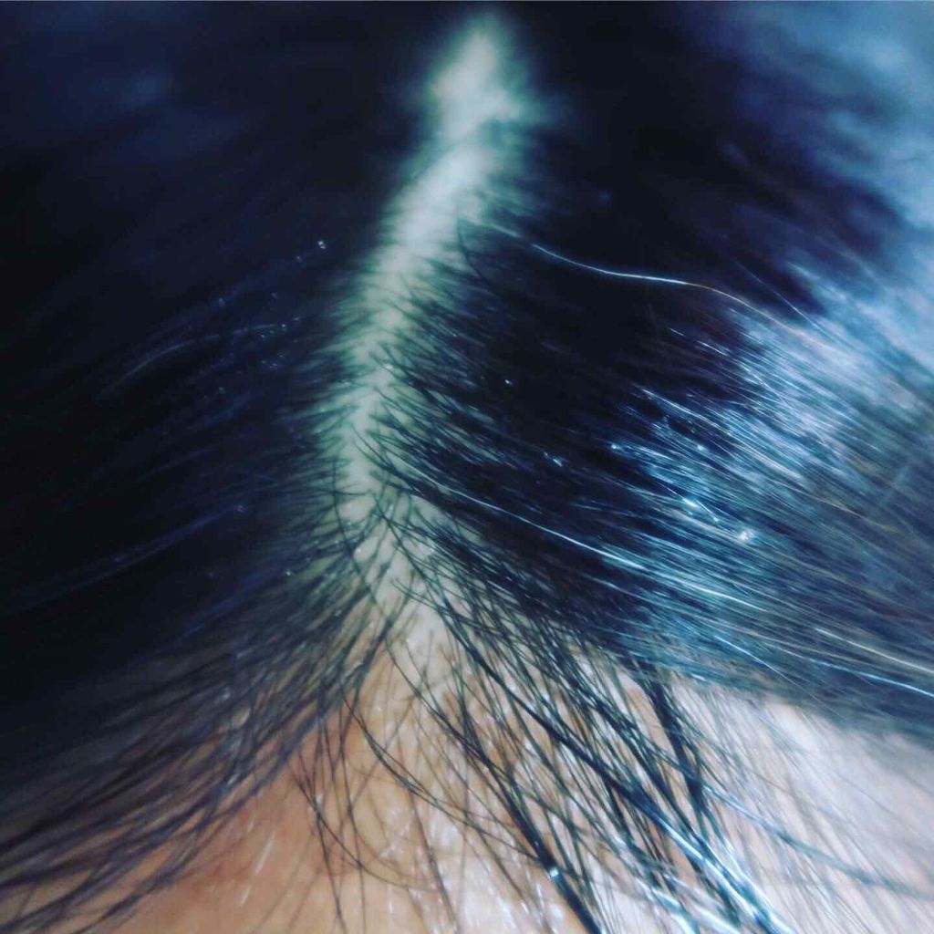 薬用 地肌 エッセンス/ラサーナ/頭皮ローションを使ったクチコミ(3枚目)