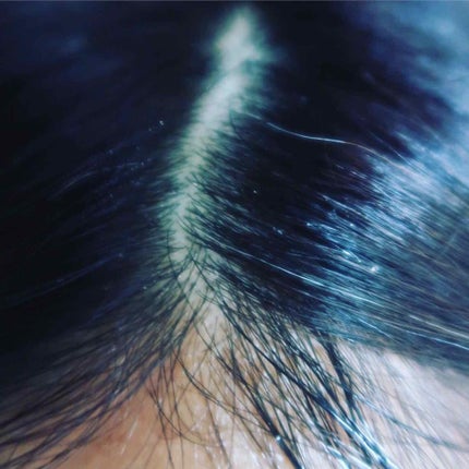 薬用 地肌 エッセンス/ラサーナ/頭皮ローションを使ったクチコミ(3枚目)