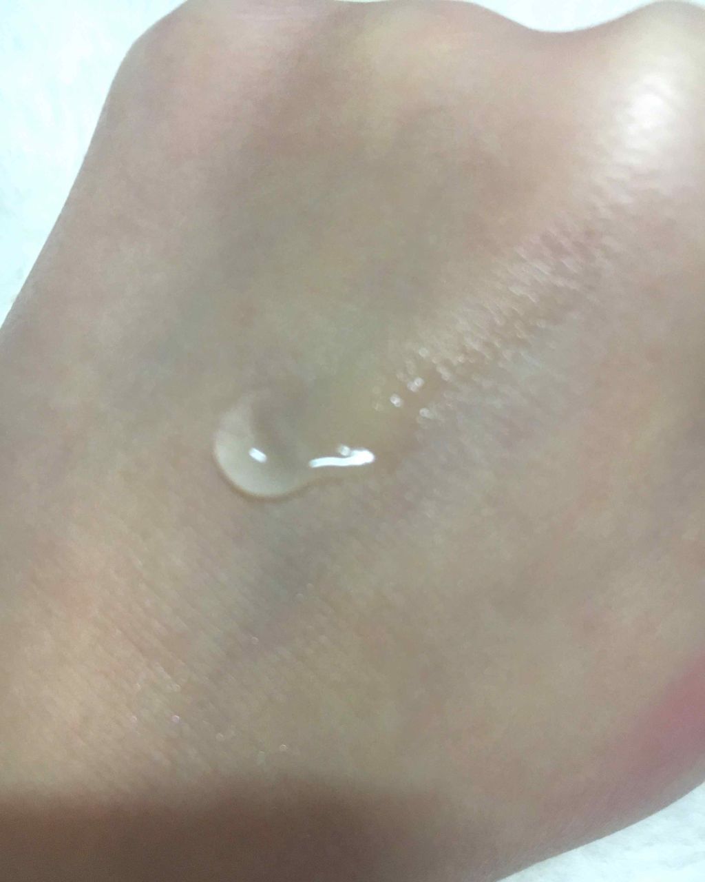 ダラシンTゲル 1% (医薬品)/佐藤製薬/その他を使ったクチコミ（2枚目）