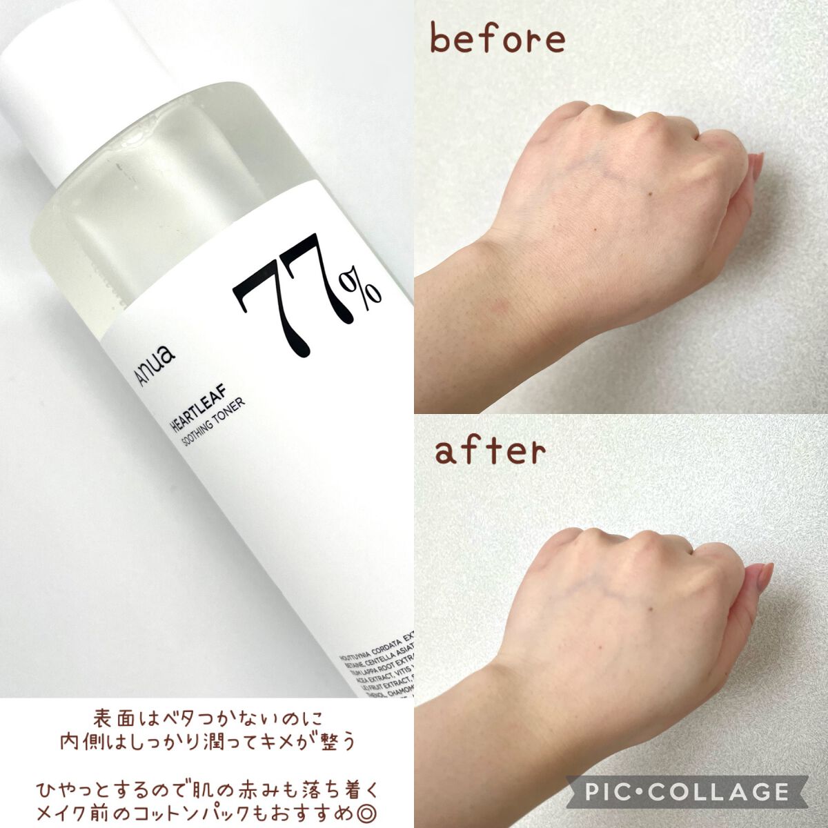 ドクダミ 77 スージングトナー/Anua/化粧水を使ったクチコミ（3枚目）