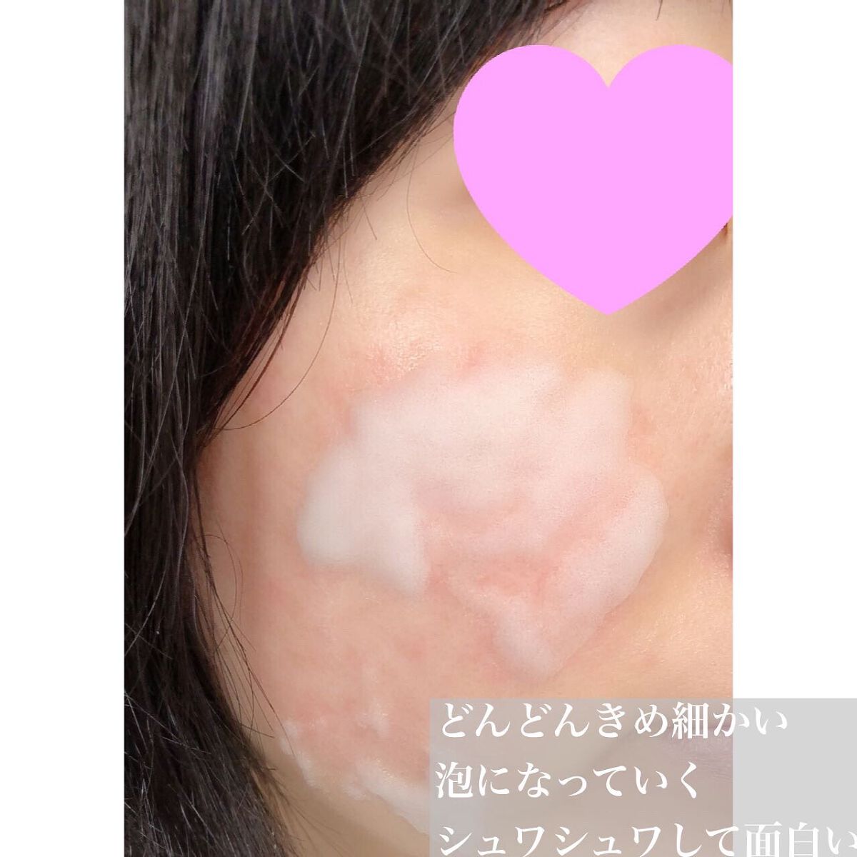 マジックバブルエッセンスパックMINI/BAKER7/シートマスク・パックを使ったクチコミ（3枚目）