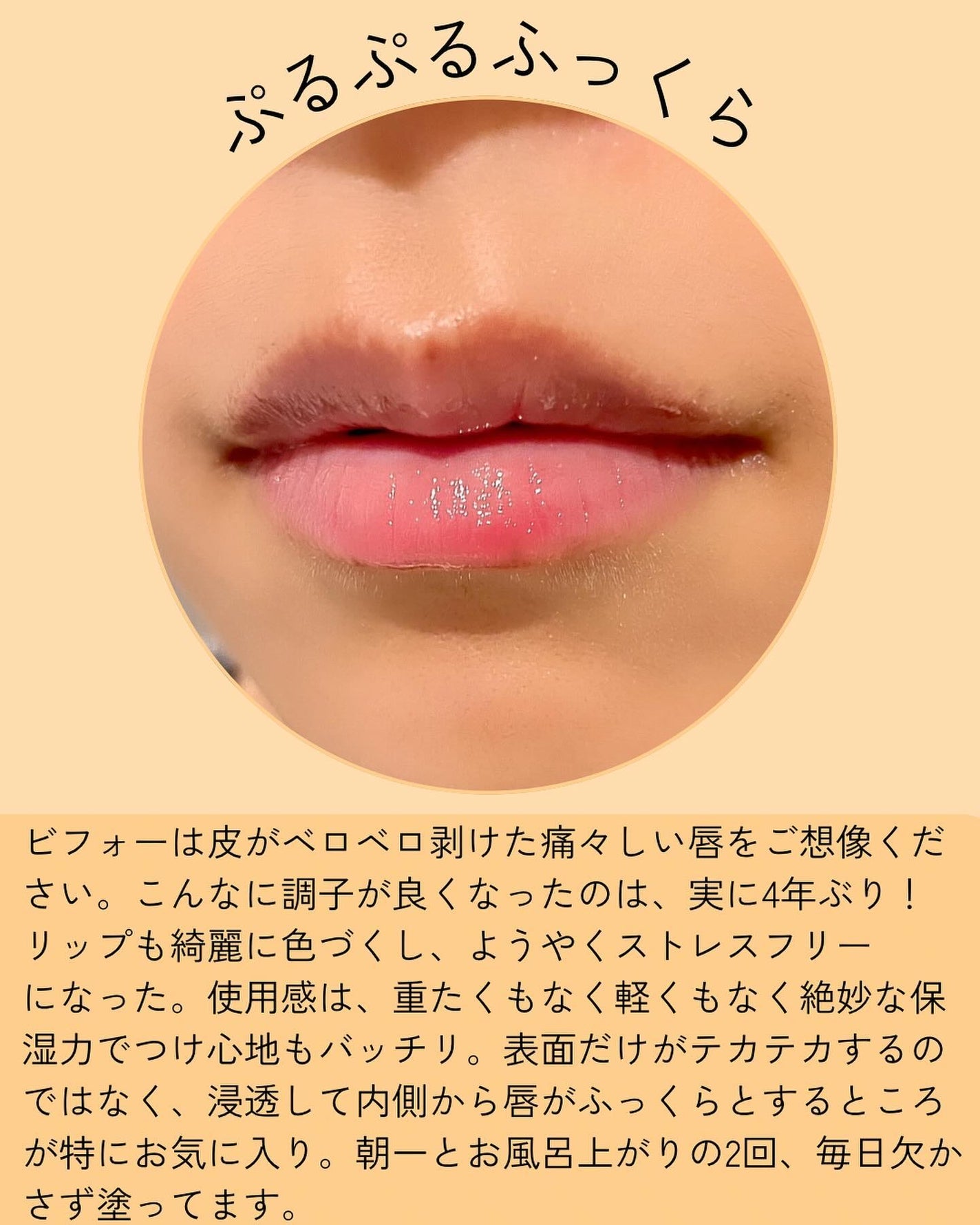 ダーマパワーX リップエッセンス/オバジ/リップ美容液を使ったクチコミ(3枚目)