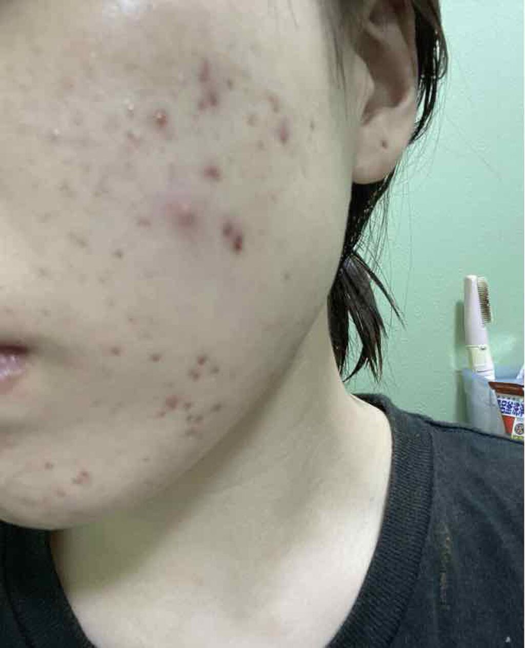 Glycolic Acid 7% Toning  Solution/The Ordinary/ブースター・導入液を使ったクチコミ（3枚目）