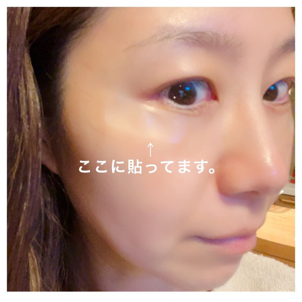 W+ マイクロ ニードル パッチ/SNP/アイケア・アイクリームを使ったクチコミ(4枚目)