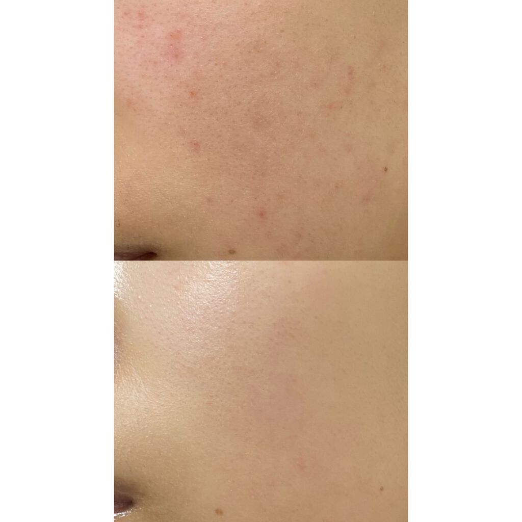 みぃ フォロバいいね返し100 on LIPS 「1枚目からお見苦しい写真で申し訳ありません🥲今回は私が水を飲み..」(3枚目)