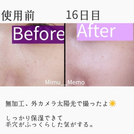 リードルショット300/VT/美容液を使ったクチコミ(5枚目)