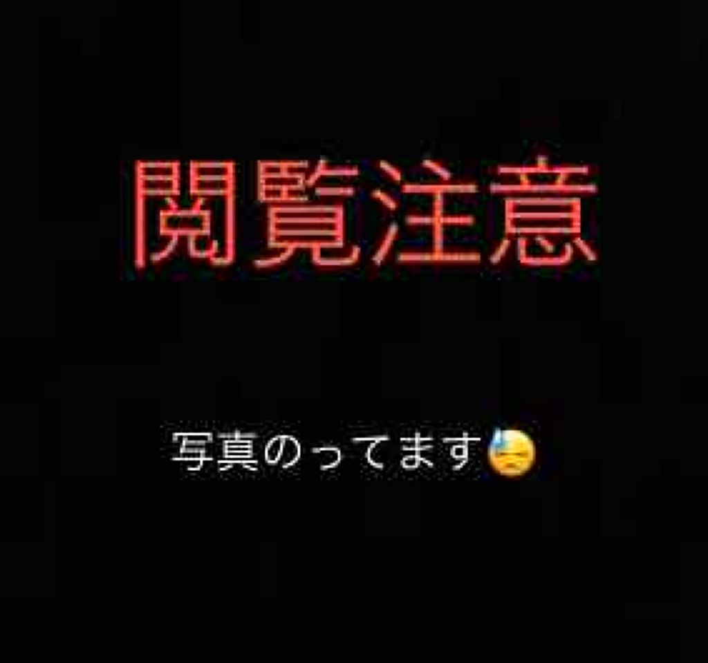 ペアアクネクリームW(医薬品)/ペア/その他を使ったクチコミ(1枚目)