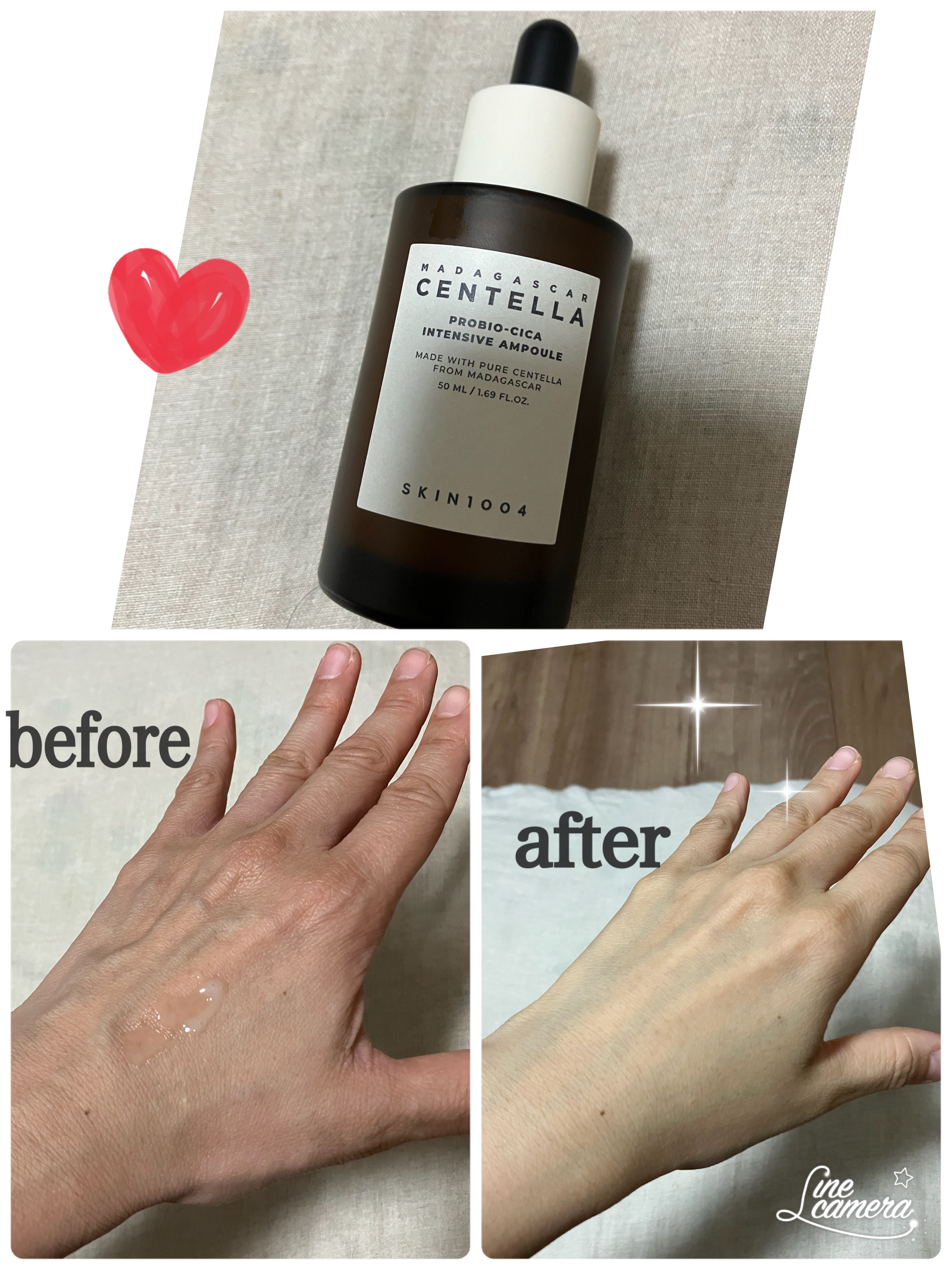 プロバイオシカ インテンシブ アンプル/SKIN1004/美容液を使ったクチコミ（1枚目）