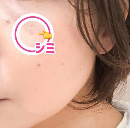 薬用PWコンシーラー/DHC/リキッドコンシーラーを使ったクチコミ(4枚目)