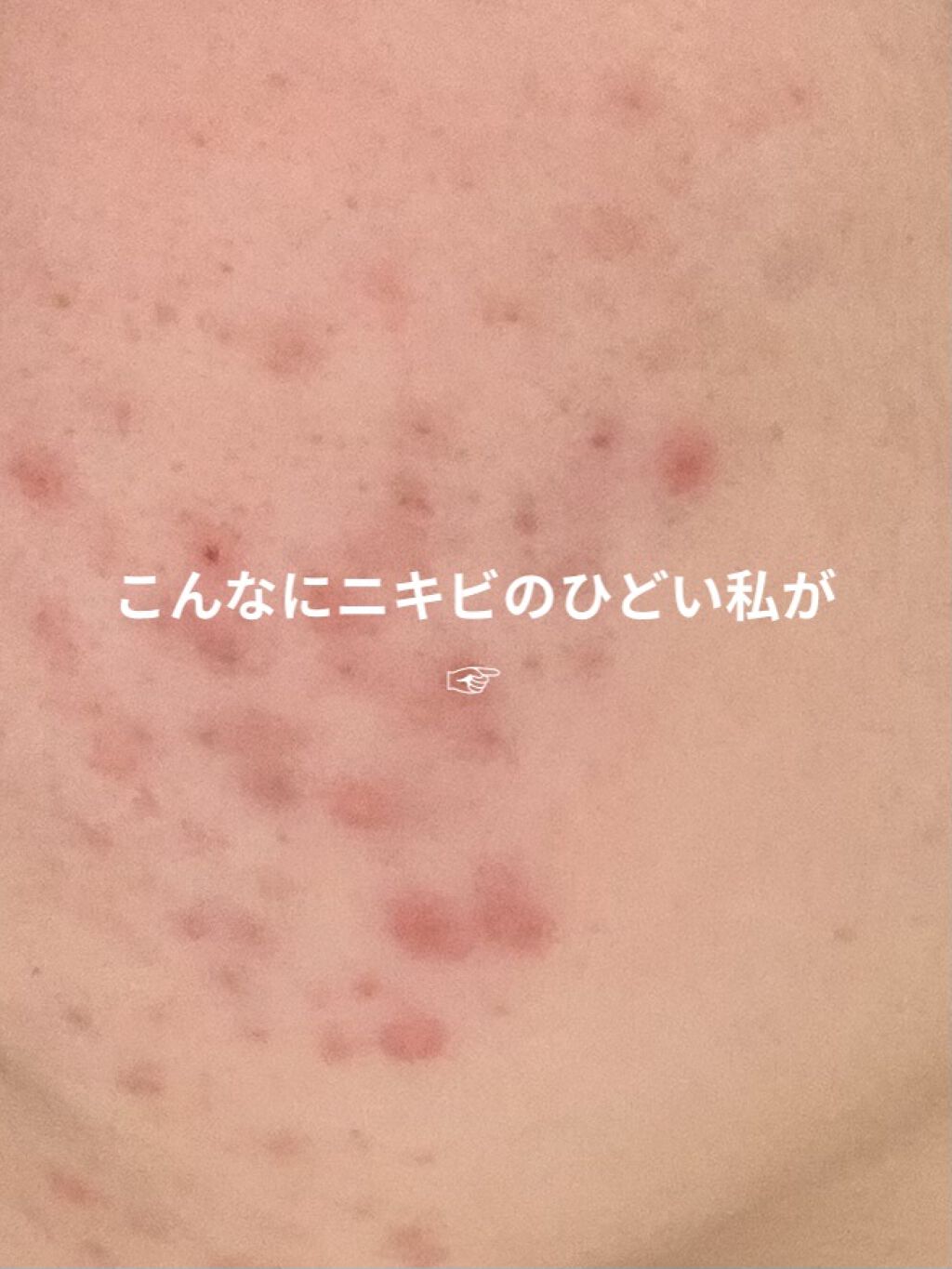 ホホバオイル/無印良品/ボディオイルを使ったクチコミ（1枚目）