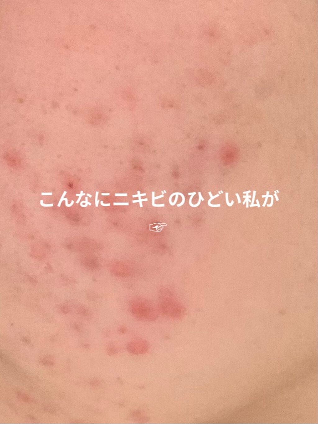 ホホバオイル/無印良品/ボディオイルを使ったクチコミ(1枚目)