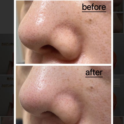 カロテンIPMP(TM) とろけるクレンジングバーム /APRILSKIN/クレンジングバームを使ったクチコミ(6枚目)