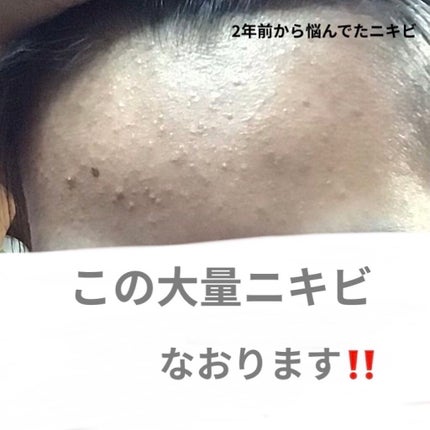 化粧水・敏感肌用・高保湿タイプ/無印良品/化粧水を使ったクチコミ(1枚目)