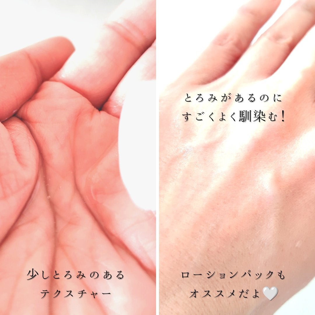 デルミールベータリッチローション/EPORASHE/化粧水を使ったクチコミ(6枚目)