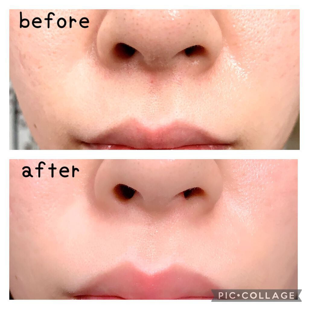 サーモウェイブアイリフト/Makeon/美顔器・マッサージを使ったクチコミ（2枚目）