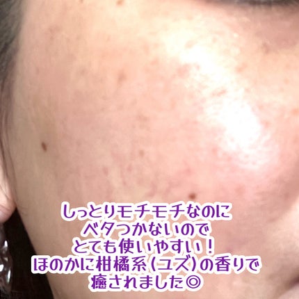 美電流マスク/Natuore Recover/シートマスク・パックを使ったクチコミ(5枚目)