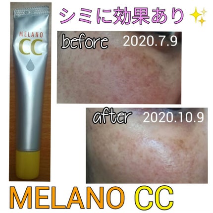 薬用 しみ 集中対策 美容液/メラノCC/美容液を使ったクチコミ(1枚目)