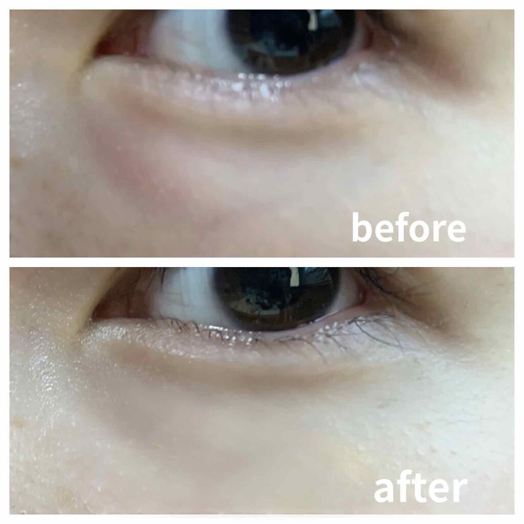 スティックコンシーラーA/KATE/スティックコンシーラーを使ったクチコミ（2枚目）