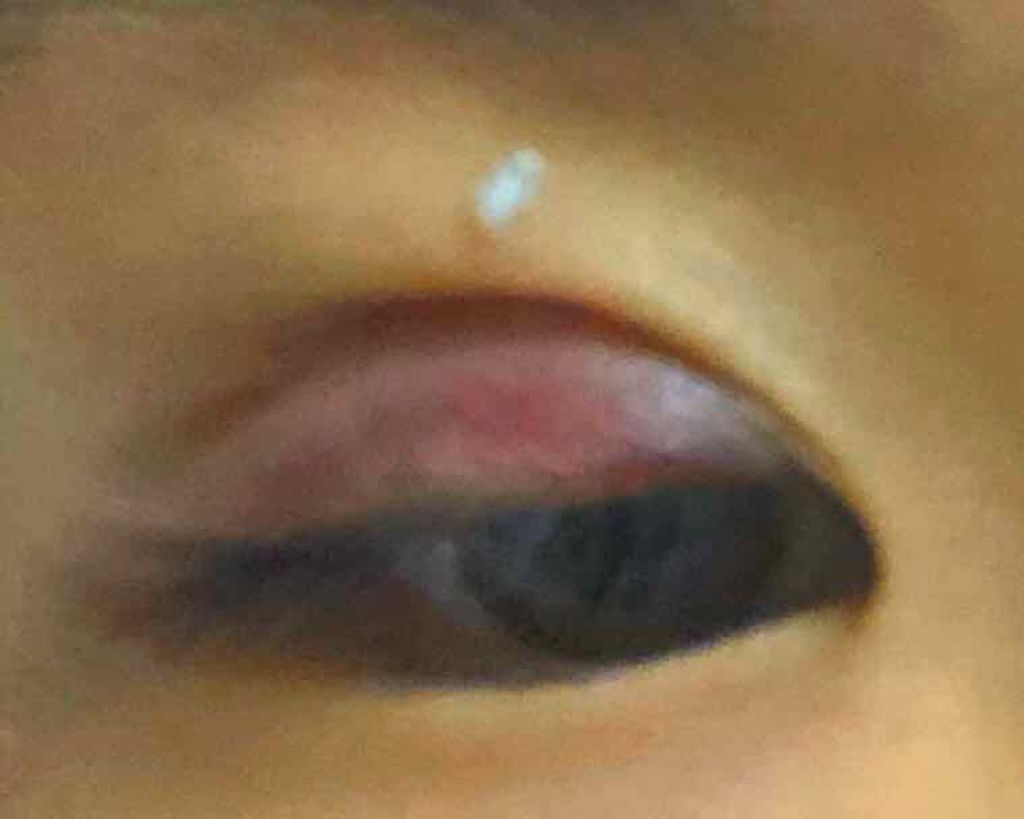 アイトーク/アイトーク/二重まぶた用アイテムを使ったクチコミ(2枚目)