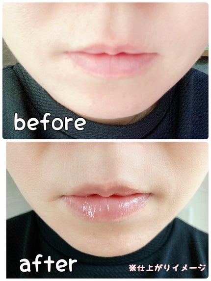 ジルスチュアート クリスタルブルーム リップブーケ セラム/JILL STUART/リッププランパーを使ったクチコミ(4枚目)