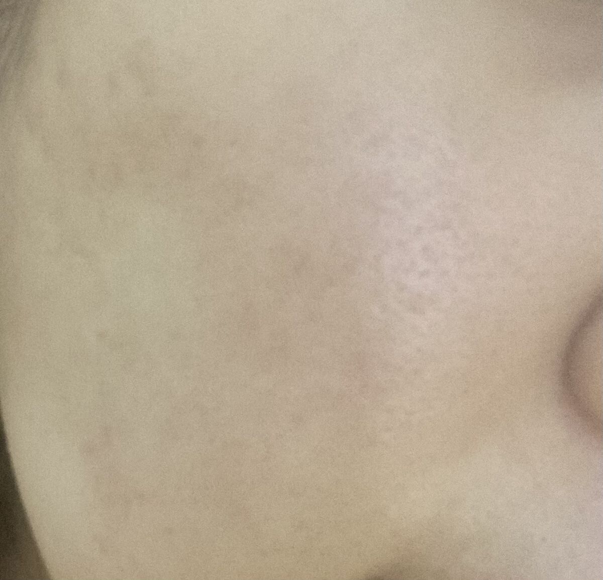 うるうるBOMBマスク/クリアターン/シートマスク・パックを使ったクチコミ（2枚目）