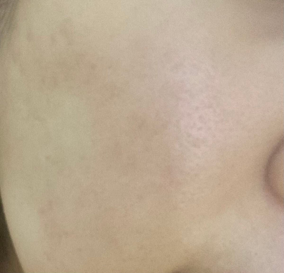 うるうるBOMBマスク/クリアターン/シートマスク・パックを使ったクチコミ(2枚目)