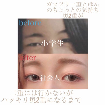 ダブルアイリキッド/Automatic Beauty/二重まぶた用アイテムを使ったクチコミ(1枚目)