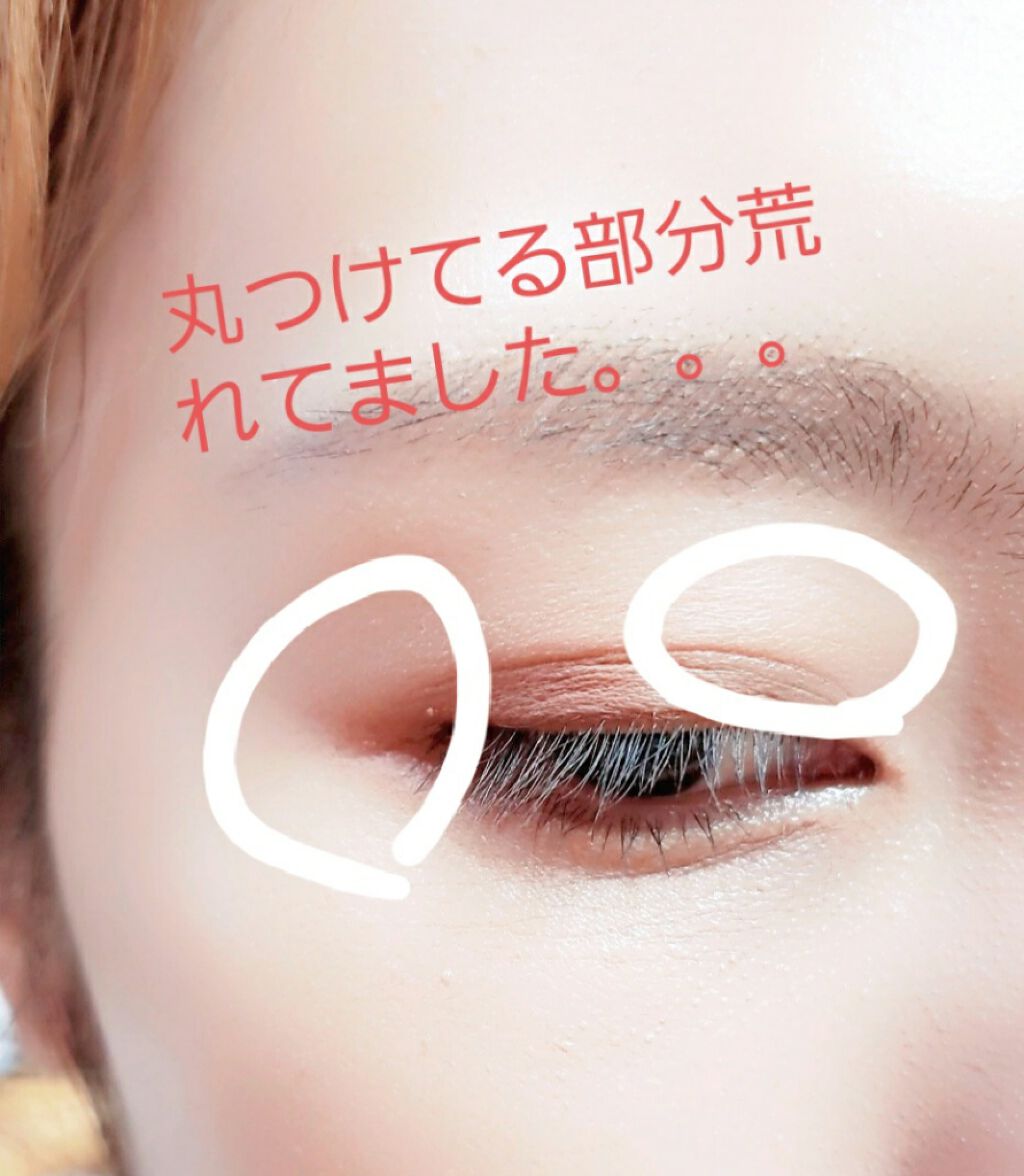フルコートf 医薬品 田辺三菱製薬の口コミ 注意 目の周りに塗ったらダメなやつで By 夷崎ちあ 体調不調 乾燥肌 Lips