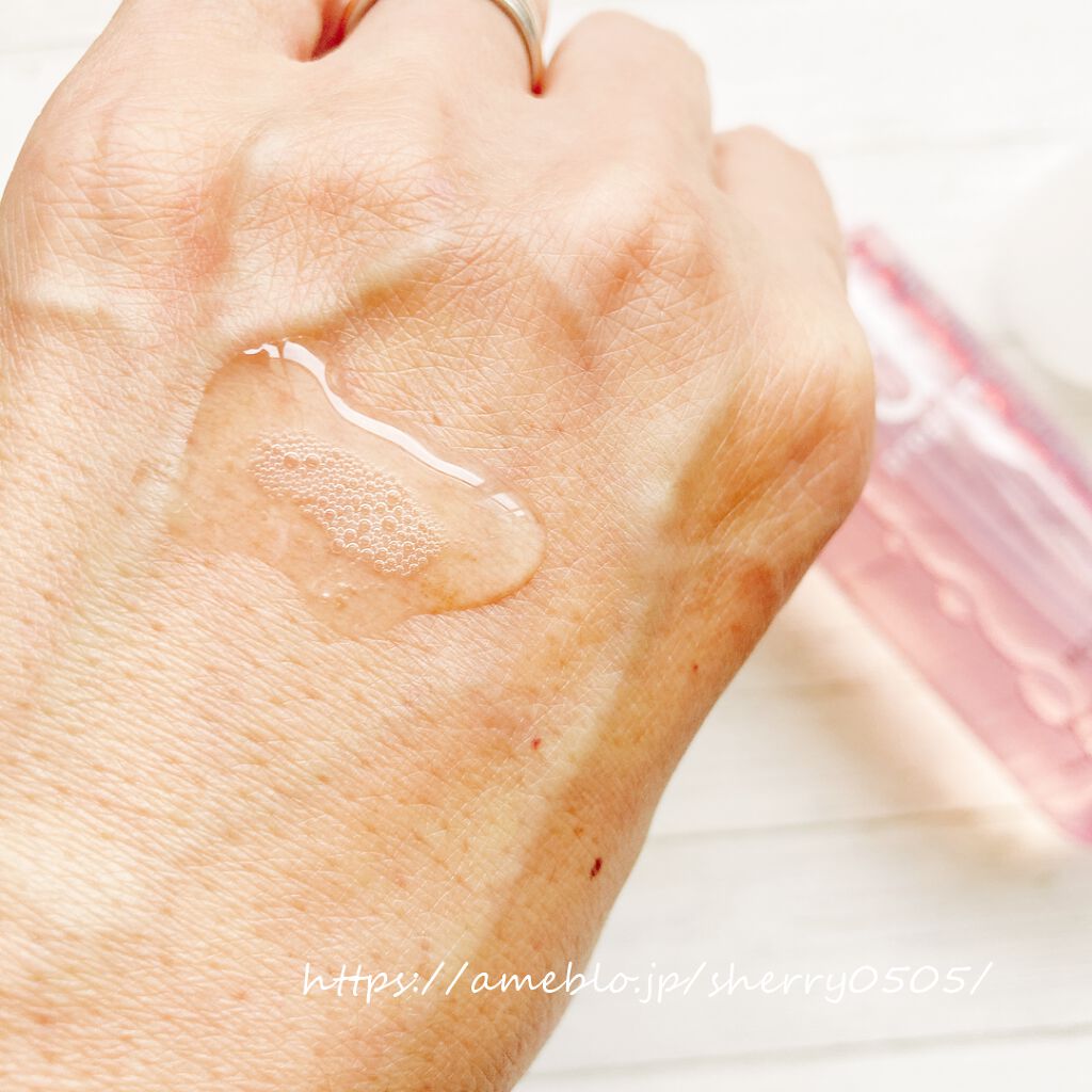 モイストケア ローション MB/d プログラム/化粧水を使ったクチコミ（2枚目）