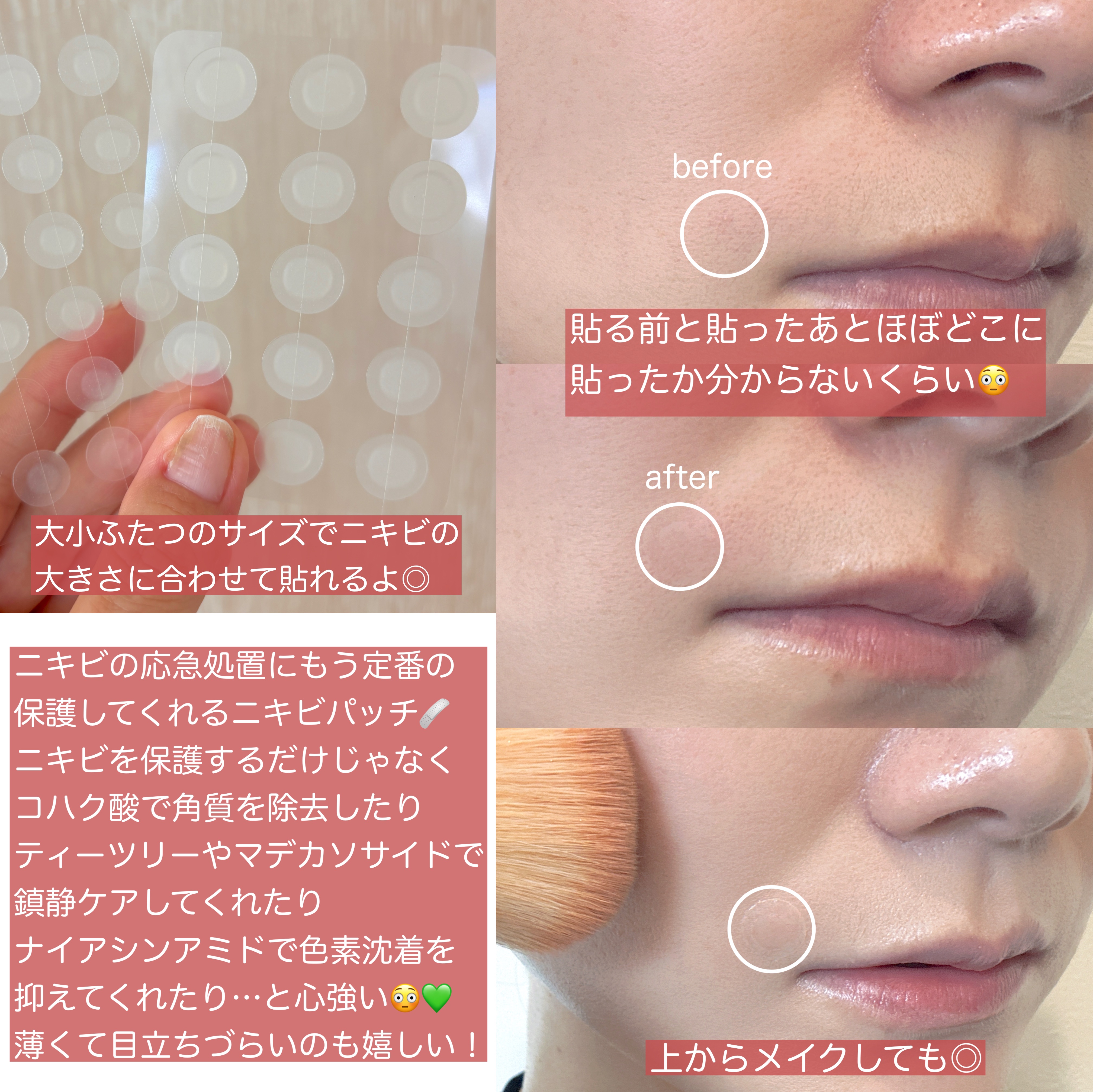 エイクリアスポットキュアパッチ/Dr.G/その他スキンケアを使ったクチコミ（3枚目）