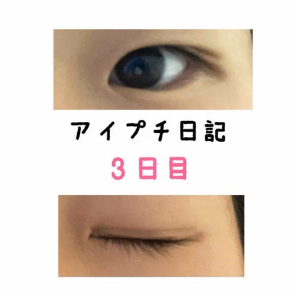 アイテープ(絆創膏タイプ、レギュラー、70枚)/DAISO/二重まぶた用アイテムを使ったクチコミ(1枚目)