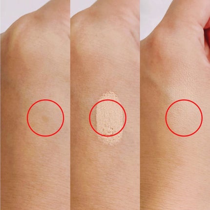 湘南美容コンシーラー/湘南美容/スティックコンシーラーを使ったクチコミ(7枚目)