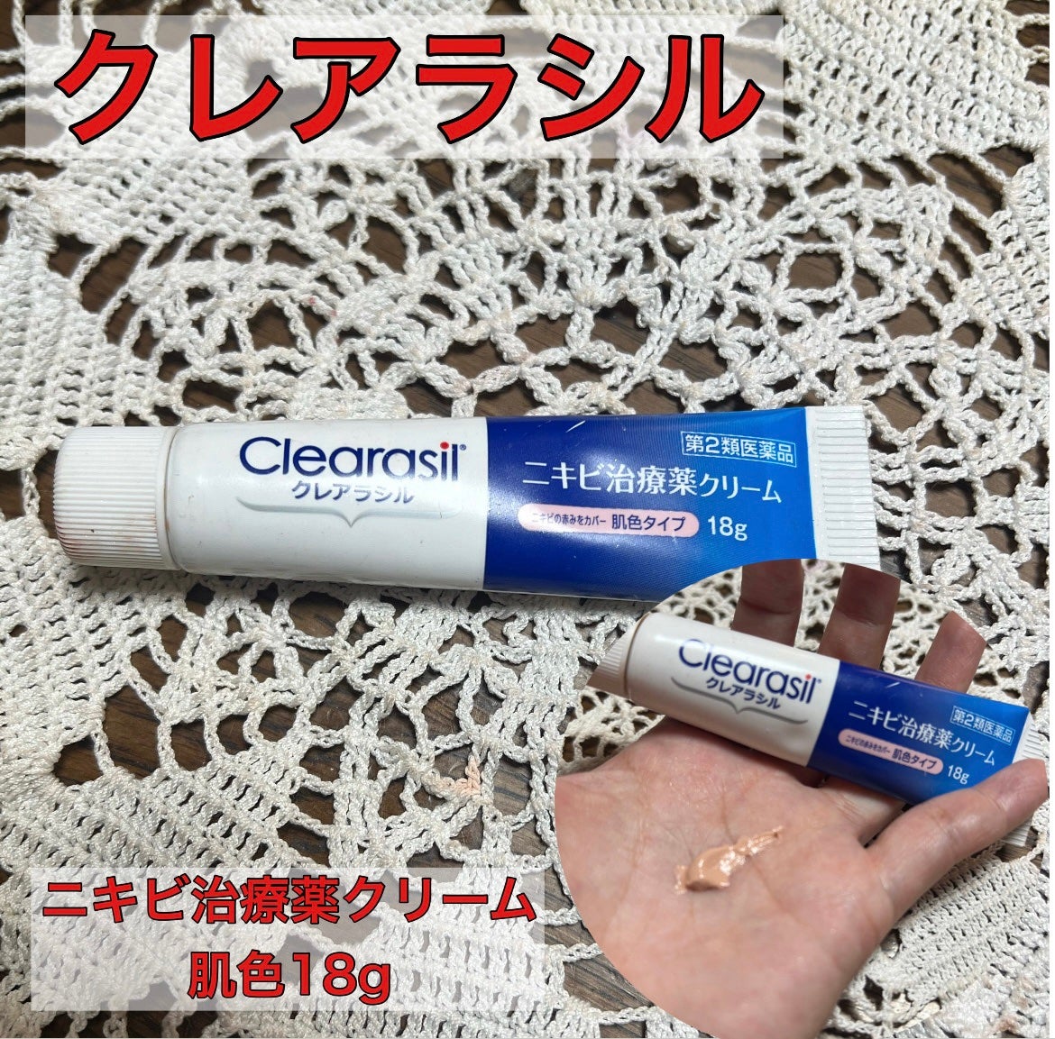 ニキビ治療薬クリーム (医薬品)/クレアラシル/その他を使ったクチコミ(1枚目)