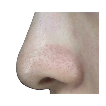 デュオ ザ クレンジングバーム ブラックリペア /DUO/クレンジングバームを使ったクチコミ(5枚目)