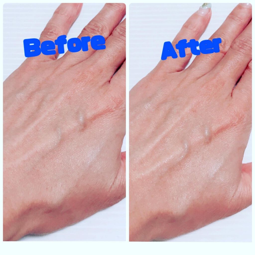 ルメント ホワイトニングジェル/Le ment/オールインワン化粧品を使ったクチコミ(3枚目)