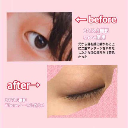 薬用 しみ 集中対策 美容液/メラノCC/美容液を使ったクチコミ(2枚目)