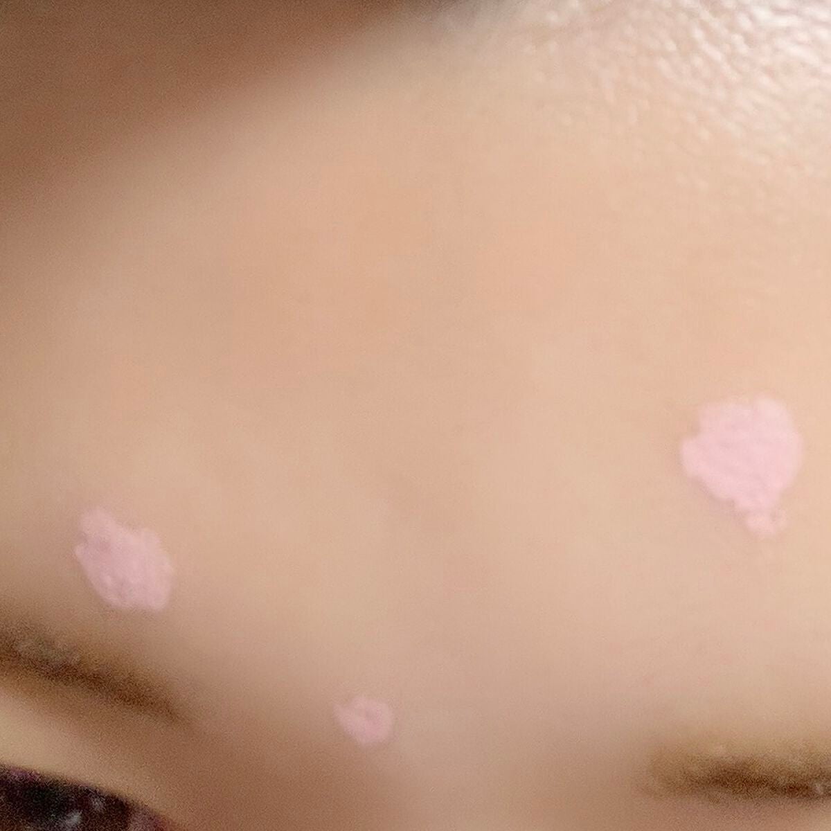 スポットパウダーエッセンス/ポツント/美容液を使ったクチコミ(4枚目)