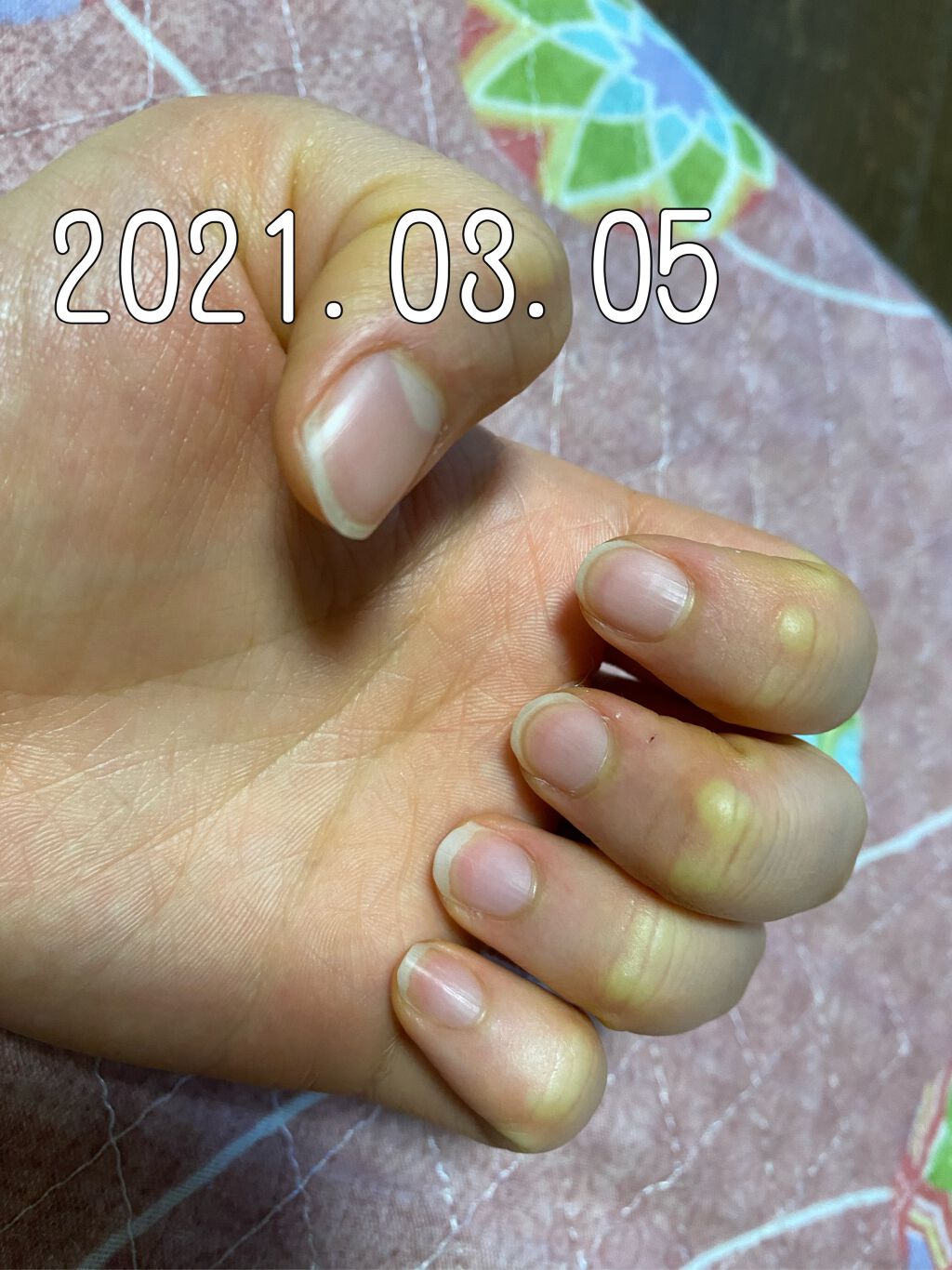 キューティクルオイル/ネイルホリック/ネイルオイル・トリートメントを使ったクチコミ(2枚目)