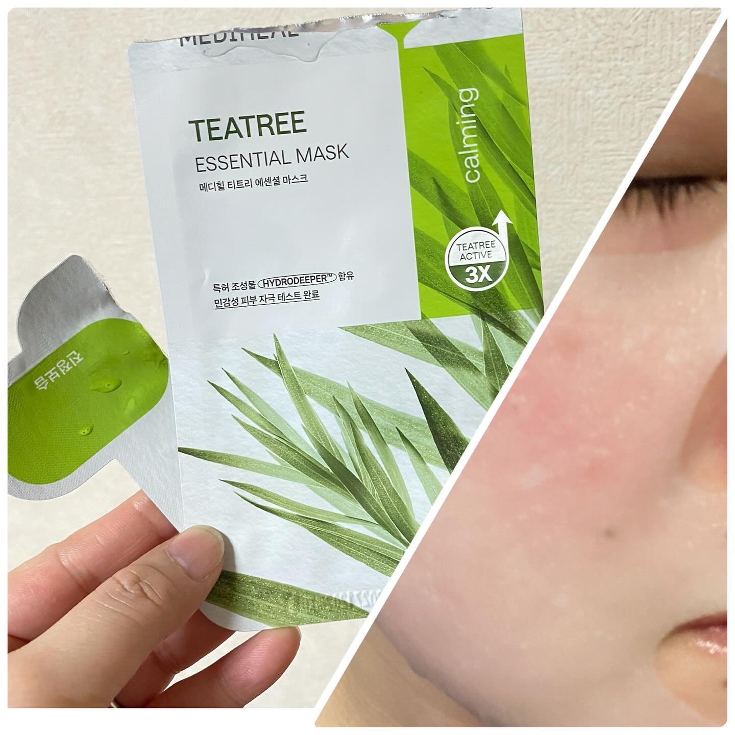 ティーツリー エッセンシャルマスクカーミングモイスチャー/MEDIHEAL/シートマスク・パックを使ったクチコミ（2枚目）
