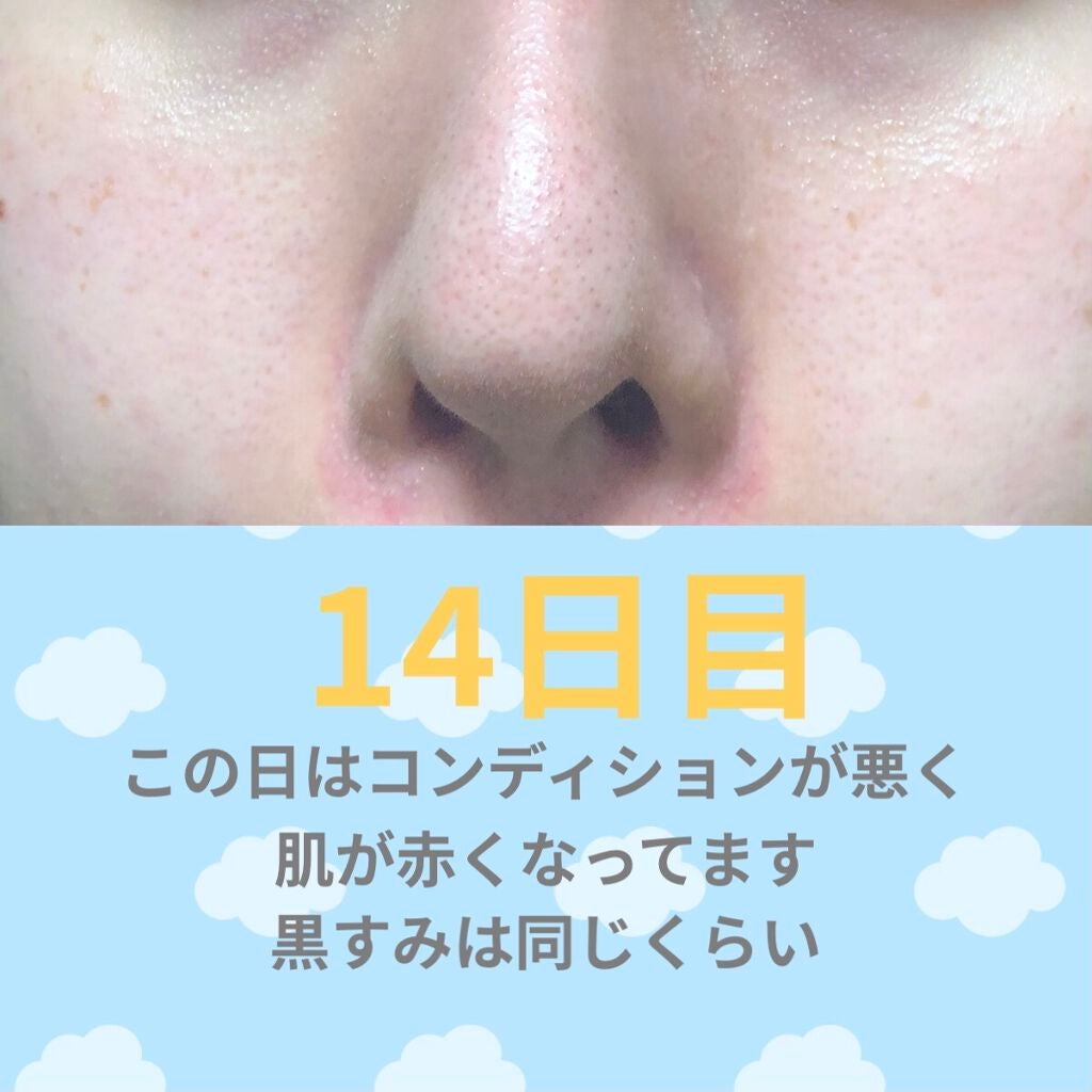 ゼロ毛穴パッド 2.0/MEDICUBE/トナーパッドを使ったクチコミ(4枚目)