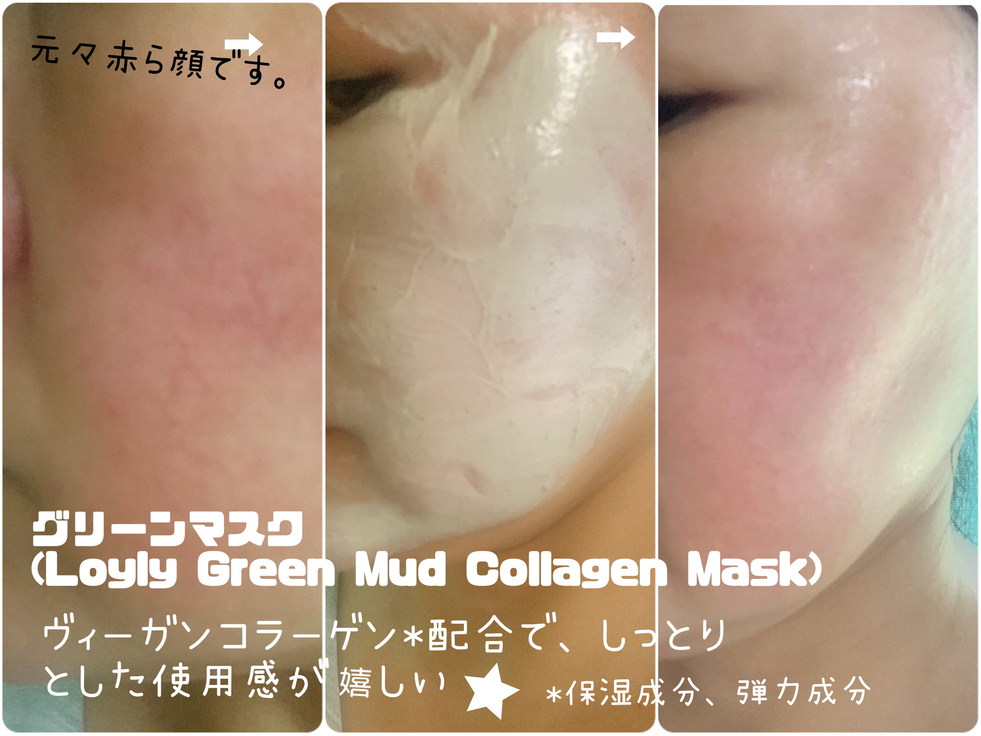 グリーンマスク/Torhop/洗い流すパック・マスクを使ったクチコミ（3枚目）