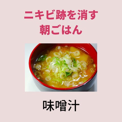 ニキビコーチ@けん on LIPS 「こんにちは!!”ニキビコーチ@けん”と申します!Instagr..」(5枚目)