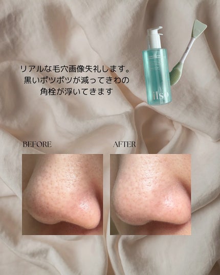 スーパーメルティングセバムクレンジングオイル/ilso/オイルクレンジングを使ったクチコミ(4枚目)