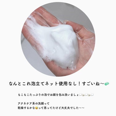 パーフェクトホイップ アクネケア/SENKA（専科）/洗顔フォームを使ったクチコミ（4枚目）