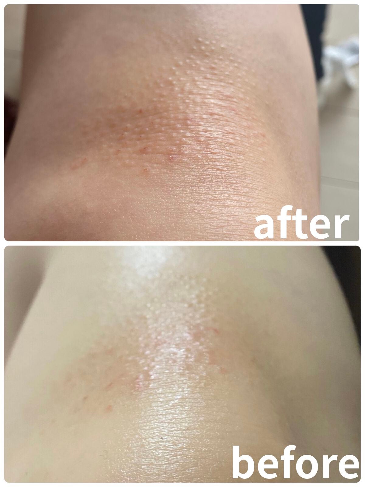 化粧水・敏感肌用・高保湿タイプ/無印良品/化粧水を使ったクチコミ(5枚目)